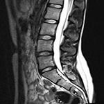 Фото категории мрт-обследований