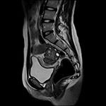 Фото категории мрт-обследований