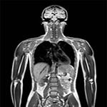 Фото категории мрт-обследований